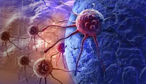 Illustrazioni di cellule tumorali (Depositphotos)